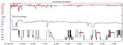 Case Report: Considerations of nocturnal ventilator support in ROHHAD syndrome in chronic care of childhood central hypoventilation with hypothalamus dysfunction